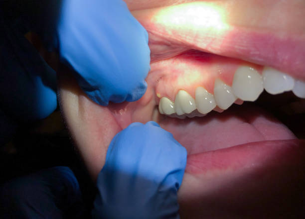 Best Emergency Treatment for Toothache in Sidney, OH